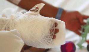 El fuego no apagó su vida, pero sí su sonrisa y su alegría