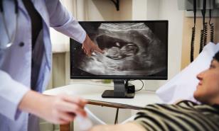 Del lujo a la necesidad: La sonografía, una herramienta esencial en el control del embarazo