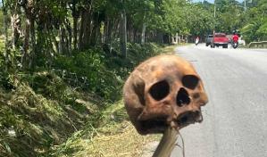 Hallan cráneo humano dentro de una caja en carretera Higüey–Santana Hallan cráneo humano dentro de una caja en carretera Higüey–Santana