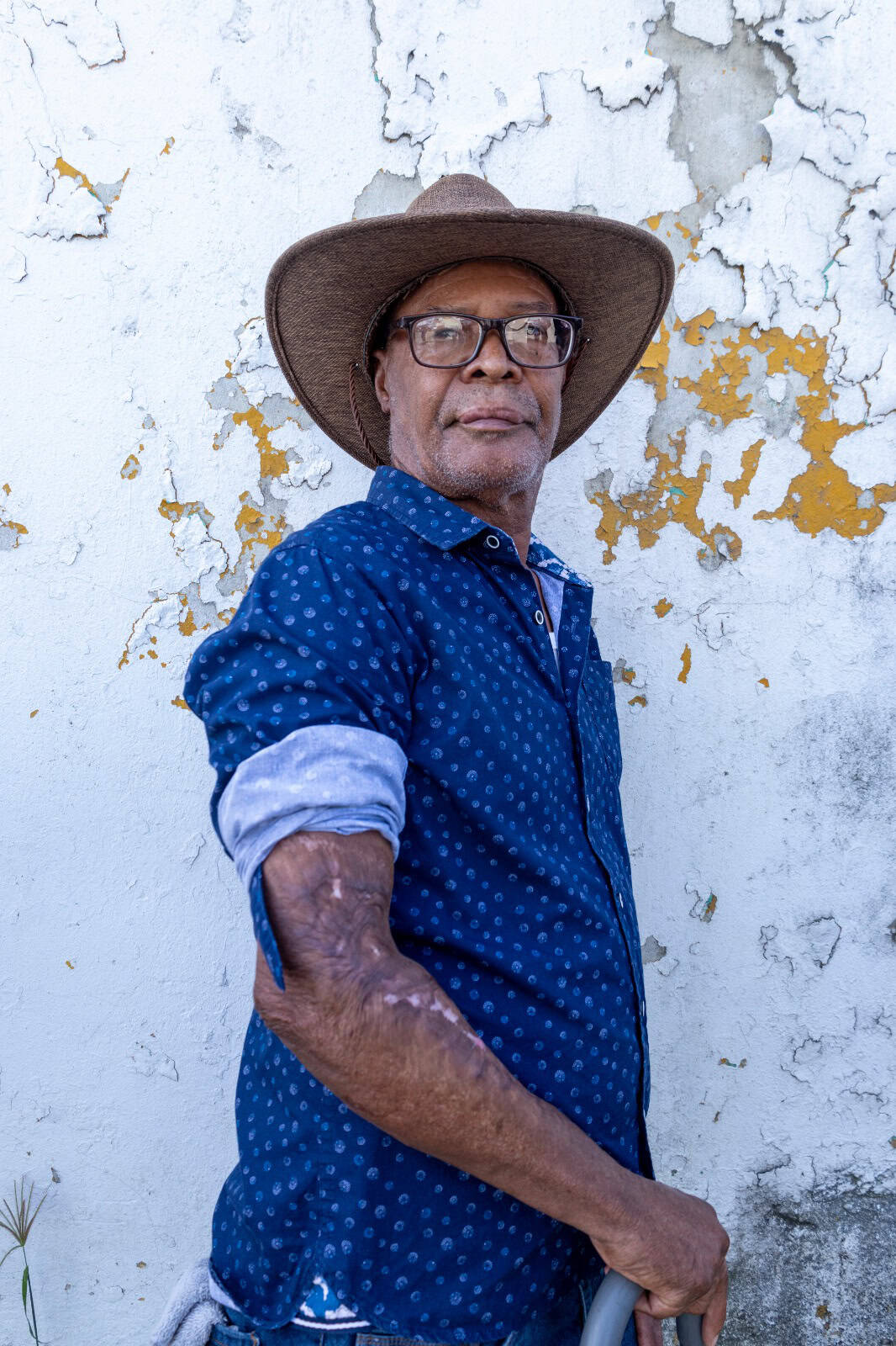 Rafael Santiago, sobreviviente de la explosión.
