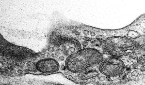 Un sorprendente hallazgo conecta un fármaco para el colesterol con la salud mental