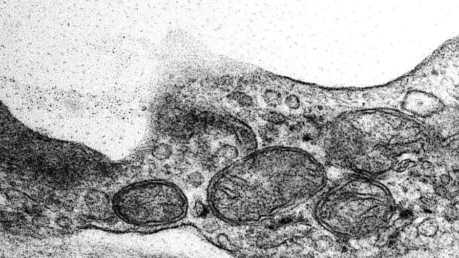 Un sorprendente hallazgo conecta un fármaco para el colesterol con la salud mental