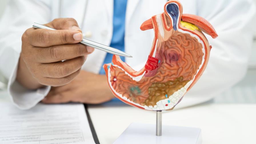 La prevención del cáncer de páncreas es posible con hábitos saludables La prevención del cáncer de páncreas es posible con hábitos saludables