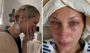 Bella Hadid publica fotos desde el hospital y desata preocupación