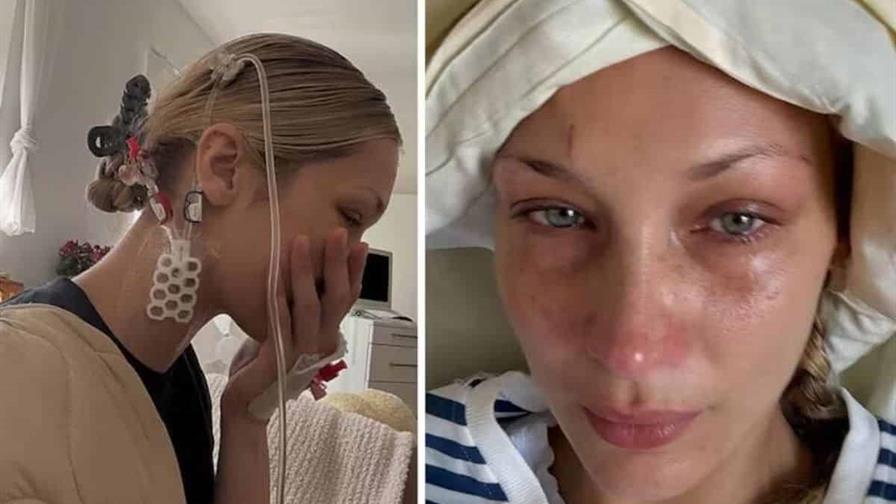 Bella Hadid publica fotos desde el hospital y desata preocupación