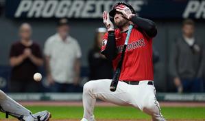 David Fry sufre fracturas faciales y será baja por semanas