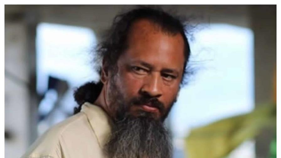 El actor dominicano Jessy Santana lucha por su vida en el Hospital Gautier; solicitan ayuda urgente
