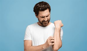 ¿Rascarse o no rascarse?: ¡esa es la cuestión!