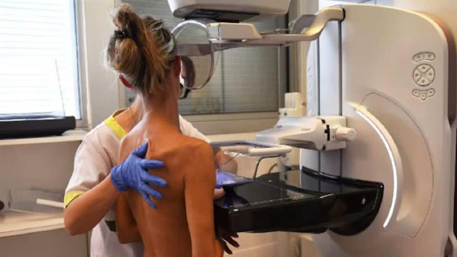 Indignación en España por retrasos en la detección del cáncer de mama Indignación en España por retrasos en la detección del cáncer de mama