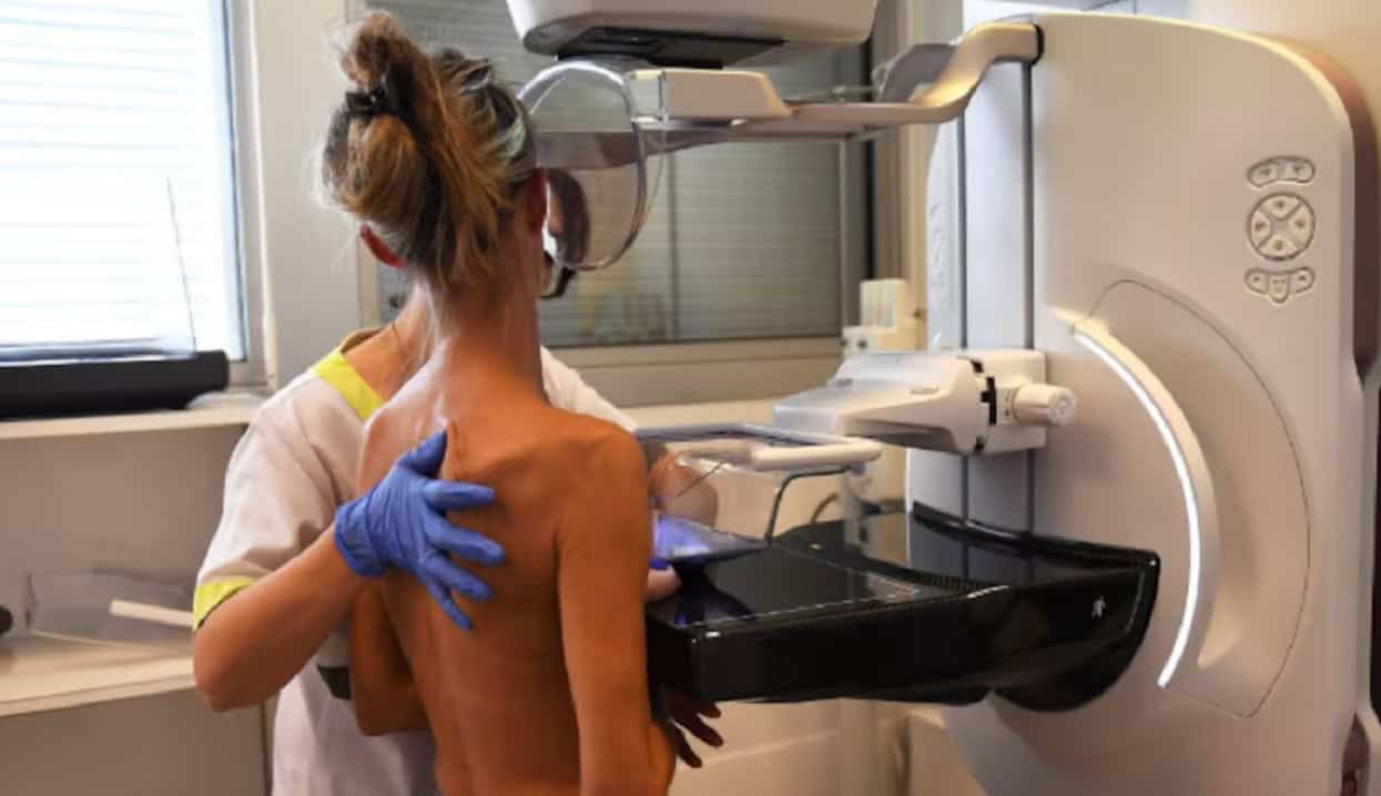 Indignación en España por retrasos en la detección del cáncer de mama Indignación en España por retrasos en la detección del cáncer de mama