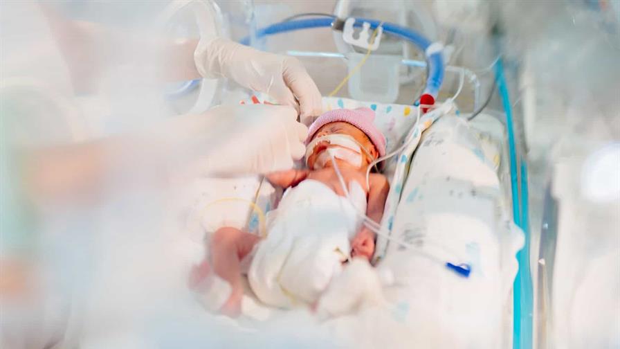 Nacimiento por cesárea, prematuridad y autismo Nacimiento por cesárea, prematuridad y autismo
