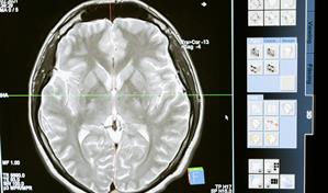 La exposición de los homínidos al plomo influyó en la evolución del cerebro