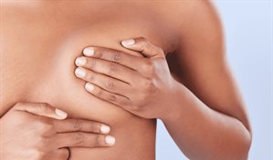 Cáncer de mama hereditario: cuando la respuesta está en tus genes