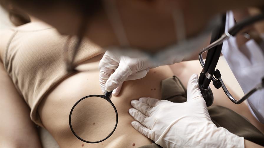 Pecas y lunares: lo que tu piel revela sobre ti Pecas y lunares: lo que tu piel revela sobre ti