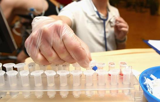 El monóxido de carbono entra en la lista de sustancias y métodos prohibidos de 2026