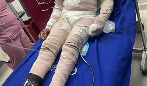 Policía apresa a mujer acusada de causar quemaduras a su pareja en La Altagracia