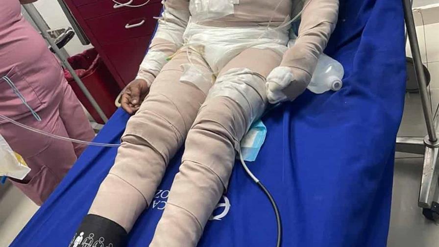 Policía apresa a mujer acusada de causar quemaduras a su pareja en La Altagracia