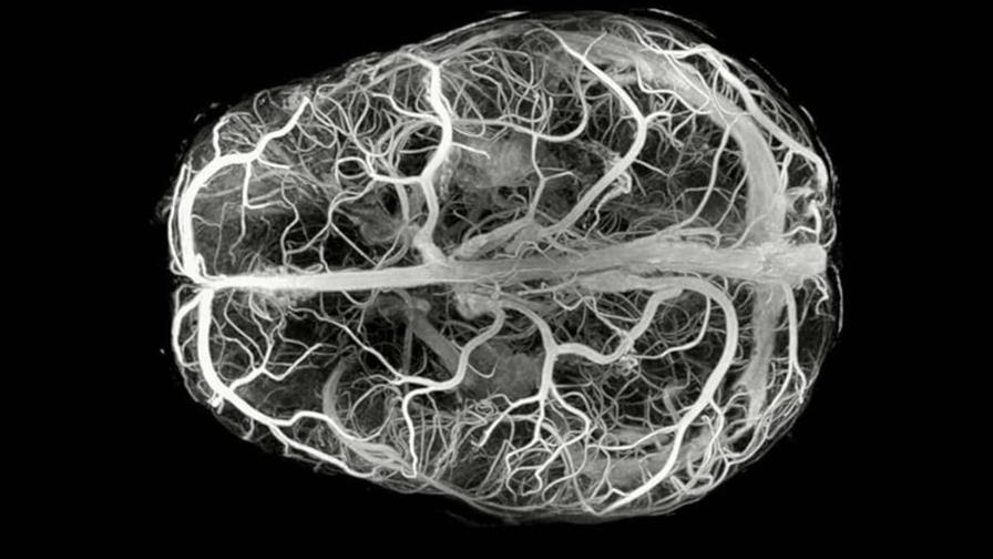 Descubren una enfermedad ultrarrara con solo 13 casos en el mundo Descubren una enfermedad ultrarrara con solo 13 casos en el mundo