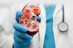 La enfermedad renal cr&oacute;nica es la novena causa principal de muerte en el mundo