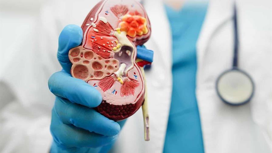 La enfermedad renal crónica es la novena causa principal de muerte en el mundo La enfermedad renal crónica es la novena causa principal de muerte en el mundo