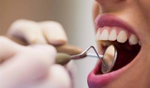 Cáncer oral: señales y riesgos que podrías estar pasando por alto