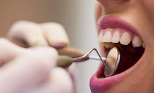 Cáncer oral: señales y riesgos que podrías estar pasando por alto