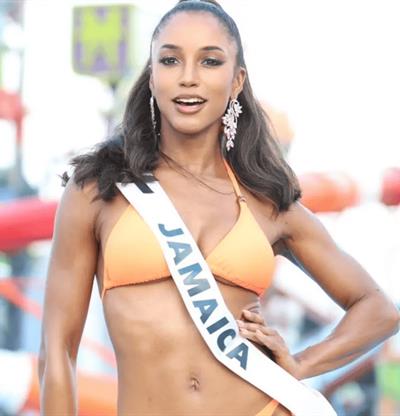 Actualizaci&oacute;n sobre la salud de Miss Jamaica: permanece en estado cr&iacute;tico pero estable