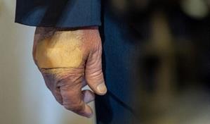 La Casa Blanca explica mano vendada de Donald Trump