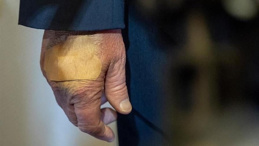 La Casa Blanca explica mano vendada de Donald Trump La Casa Blanca explica mano vendada de Donald Trump