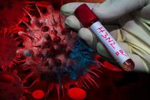 El infect&oacute;logo H&eacute;ctor Balc&aacute;cer alerta por virus H3N2 ya est&aacute; circulando en Rep&uacute;blica Dominicana