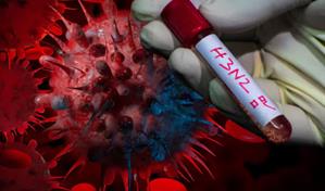 Dos menores en Lima son los primeros casos de influenza A H3N2 en Per&uacute;