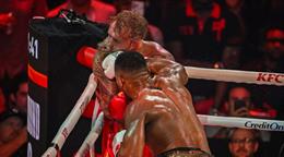 Jake Paul pasa por cirug&iacute;a de mand&iacute;bula tras pelea con Anthony Joshua