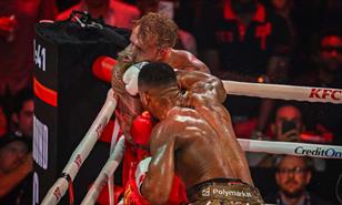 Jake Paul pasa por cirug&iacute;a de mand&iacute;bula tras pelea con Anthony Joshua