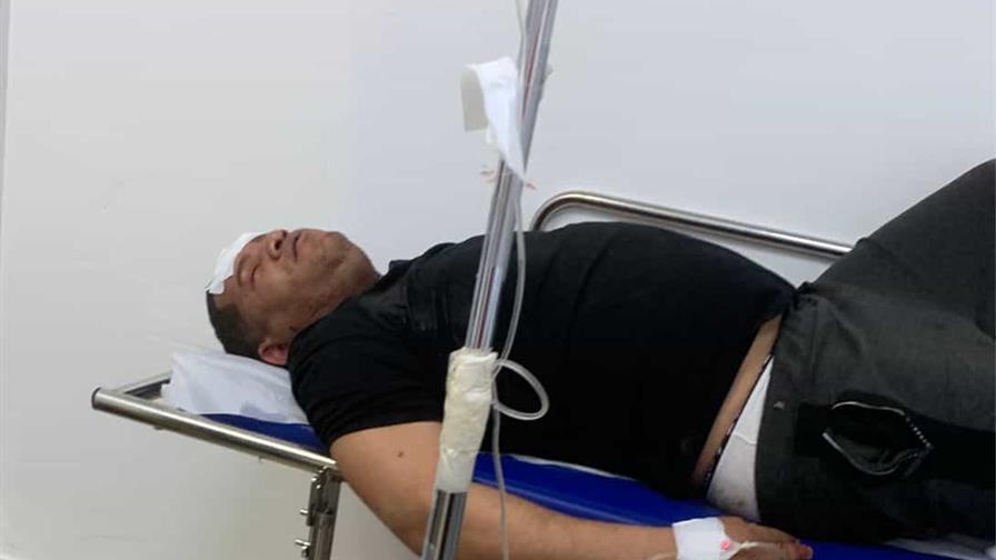 Mantequilla resulta herido en incidente que está bajo investigación de las autoridades