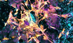 Logran implantar con &eacute;xito un embri&oacute;n en un endometrio artificial