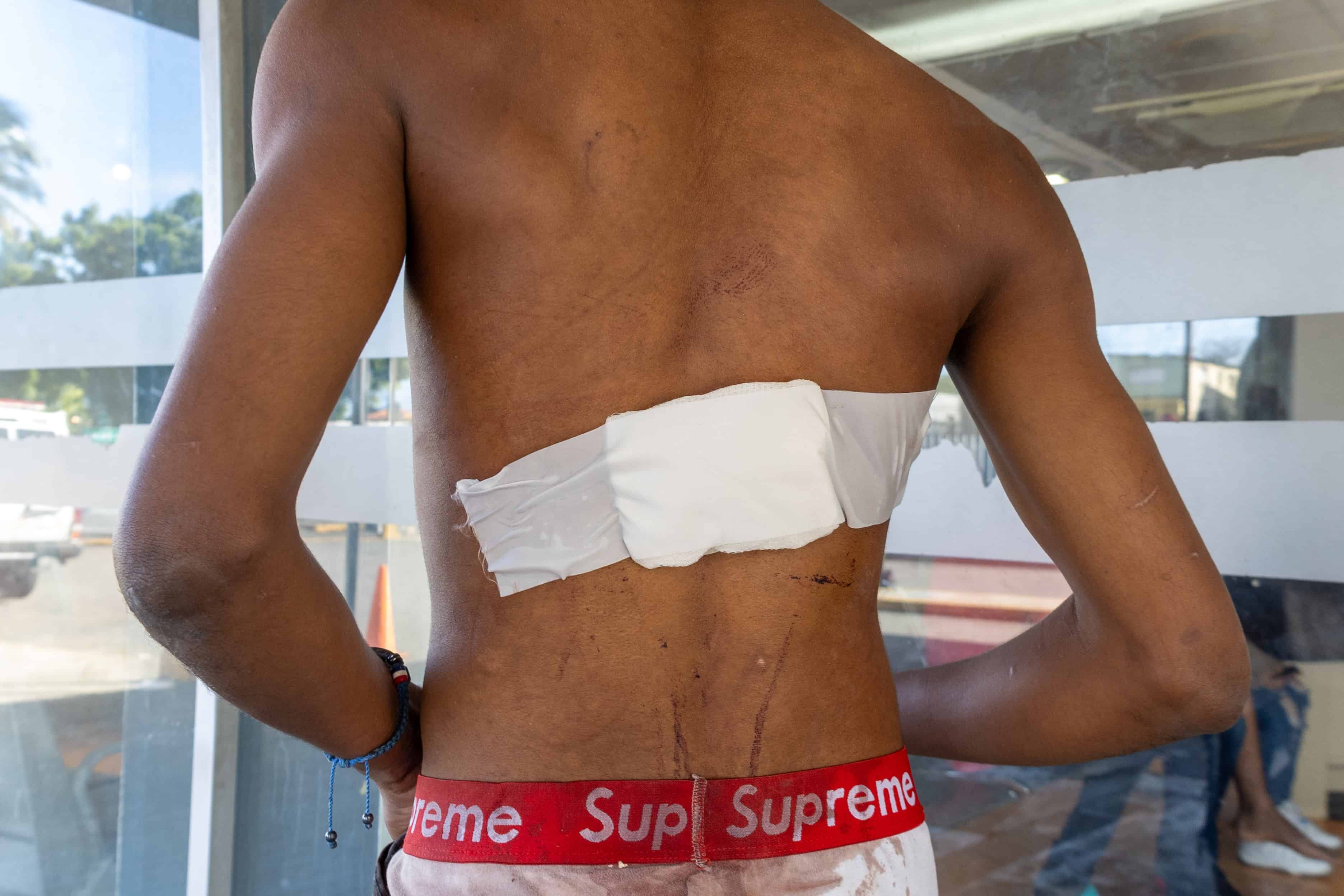 [object HTMLTextAreaElement]