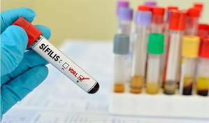 Retorno de una enfermedad olvidada: s&iacute;filis se vuelve una se&ntilde;al de desigualdad en Uruguay