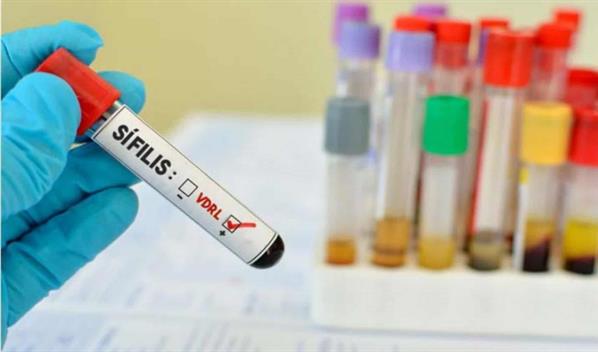 Retorno de una enfermedad olvidada: s&iacute;filis se vuelve una se&ntilde;al de desigualdad en Uruguay