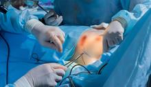 Realizan la primera cirug&iacute;a de reducci&oacute;n mamaria en el pa&iacute;s cubierta por una ARS