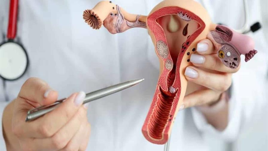 Una sola dosis de la vacuna puede evitar el c&aacute;ncer cervicouterino