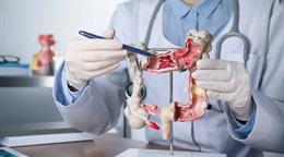 Un estudio rastrea tumores de hasta 100 a&ntilde;os para entender el avance del c&aacute;ncer intestinal