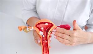 Endometriosis y s&iacute;ndrome de ovario poliqu&iacute;stico