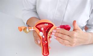 Endometriosis y s&iacute;ndrome de ovario poliqu&iacute;stico