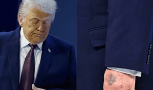 Casa Blanca atribuye moretones de Trump a golpe contra la mesa