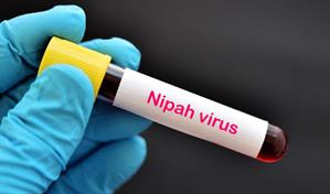 Nipah, claves de un virus emergente y sin tratamiento que mantiene en alerta a la India