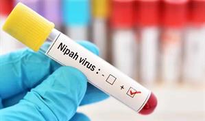 La India rebaja la alarma por el virus Nipah y confirma 196 pruebas negativas de contactos