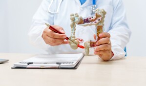 Instituto Dominicano de Gastroenterolog&iacute;a promueve detecci&oacute;n temprana del c&aacute;ncer de colon