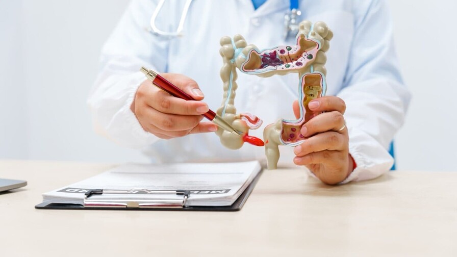 Instituto Dominicano de Gastroenterolog&iacute;a promueve detecci&oacute;n temprana del c&aacute;ncer de colon