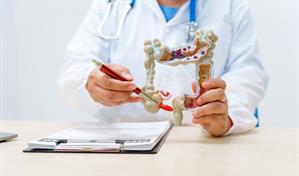 El c&aacute;ncer de colon es una enfermedad silenciosa que, muchas veces, puede prevenirse