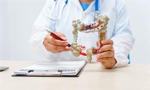 El c&aacute;ncer de colon es una enfermedad silenciosa que, muchas veces, puede prevenirse